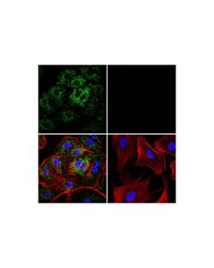 Cell Signaling Mthfd2 (E7a4l) Xp Rabbit mAb (Alexa Fluor 555 Conjugate)