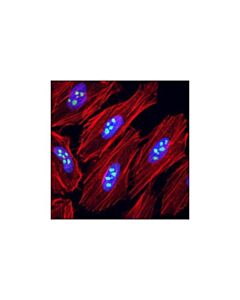 Cell Signaling Eif6 (D16e9) Xp Rabbit mAb