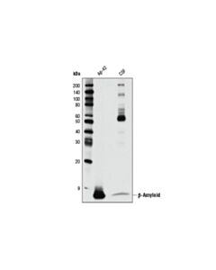 Cell Signaling Beta-Amyloid (D54d2) Rabbit mAb (BSA And Azide Free)