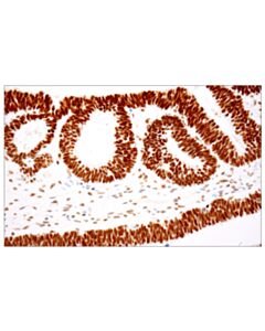 Cell Signaling Pbrm1/Baf180 (D4l9x) Rabbit mAb