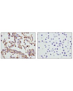 Cell Signaling Cox Iv (D6i4k) Rabbit mAb (Rodent Specific)