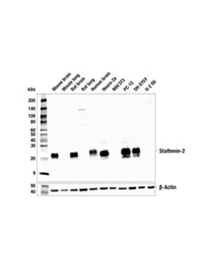 Cell Signaling Stathmin-2 (E1D2M) Rabbit mAb