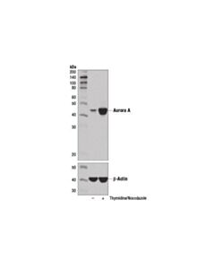 Cell Signaling Aurora Antibody Sampler Kit