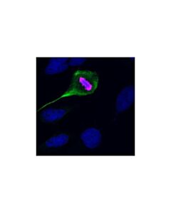 Cell Signaling Phospho-Vimentin (Ser56) Antibody