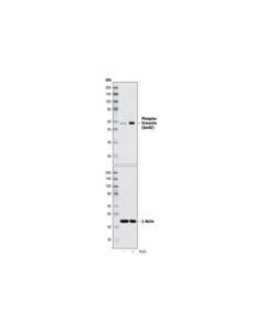 Cell Signaling Phospho-Vimentin (Ser83) Antibody