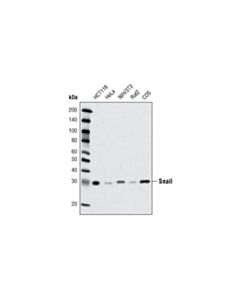 Cell Signaling Snail (C15d3) Rabbit mAb