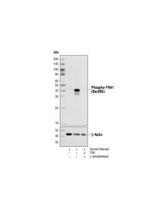 Cell Signaling Phospho-Fra1 (Ser265) Antibody