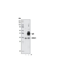 Cell Signaling Ercc1 Antibody