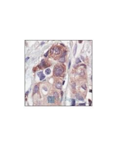 Cell Signaling Phospho-Glycogen Synthase (Ser641) Antibody