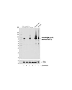 Cell Signaling Phospho-Pkc (Pan) (Gamma Thr514) (D6y3d) Rabbit mAb
