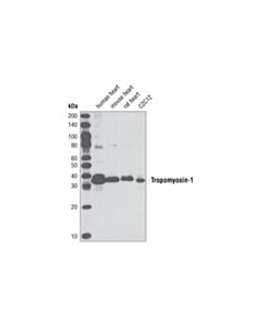 Cell Signaling Tropomyosin-1 (D12H4) Rabbit mAb 20 uL