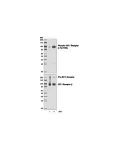 Cell Signaling Phospho-Igf-I Receptor Beta (Tyr1135) (Da7a8) Rabbit mAb