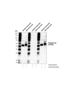 Cell Signaling Phospho-Tau (Ser202) (D4h7e) Rabbit mAb