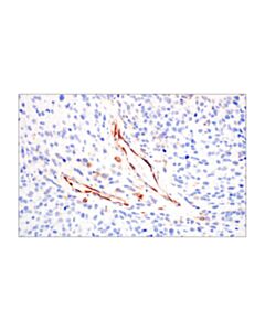 Cell Signaling Cyr61 (E5w3h) Rabbit mAb