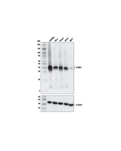 Cell Signaling CYR61 (E5W3H) Rabbit mAb 20 uL