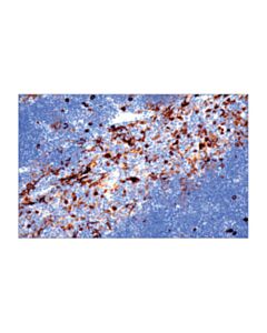Cell Signaling Il-2ralpha/Cd25 (E9w2j) Xp Rabbit mAb