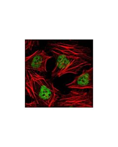 Cell Signaling Hdac3 (7g6c5) Mouse mAb