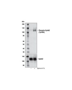 Cell Signaling Phospho-Epha2 (Tyr594) Antibody