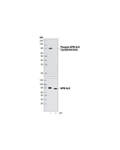 Cell Signaling Phospho-Alk (Tyr1278/1282/1283) Antibody