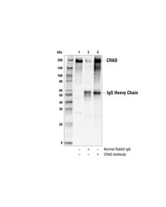 Cell Signaling Crad Antibody