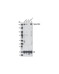 Cell Signaling Tuberin/Tsc2 (D57a9) Rabbit mAb