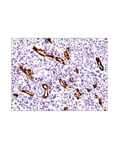 Cell Signaling Cd36 (D8l9t) Rabbit mAb (BSA And Azide Free)