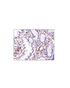 Cell Signaling Fabp5 (D1a7t) Rabbit mAb