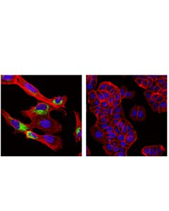Cell Signaling Col1a1 (E6a8e) Rabbit mAb