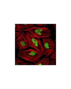 Cell Signaling Mcm2 Antibody