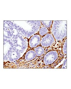 Cell Signaling Galectin-1/Lgals1 (8a12) Mouse mAb