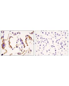 Cell Signaling Dpp4/Cd26 (D6d8k) Rabbit mAb (Ihc Formulated)