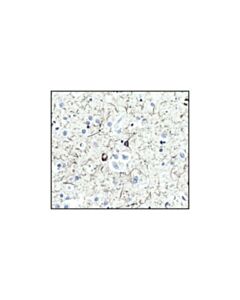 Cell Signaling Tau (Tau46) Mouse mAb