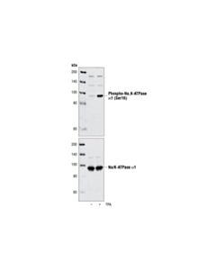 Cell Signaling Phospho-Na,K-Atpase Alpha1 (Ser16) Antibody