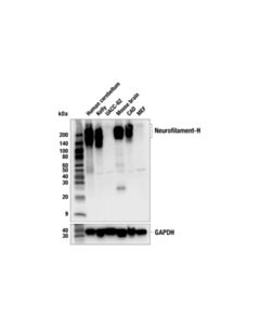 Cell Signaling Neurofilament-H (E3o6w) Mouse mAb