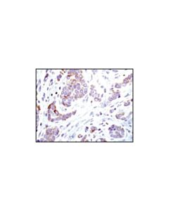 Cell Signaling Acsl1 Antibody