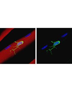 Cell Signaling M-Cadherin (D4b9l) Rabbit mAb