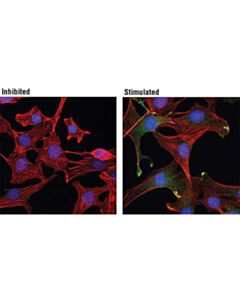 Cell Signaling Phospho-Akt (Ser473) (193h12) Rabbit mAb