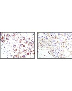 Cell Signaling Phospho-Akt (Ser473) (D9e) Xp Rabbit mAb