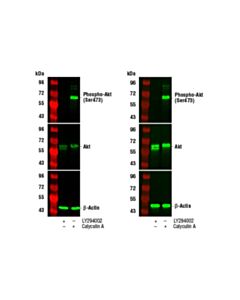 Cell Signaling Trueblack ® Fluorescent Western Blot Blocking Buffer Kit