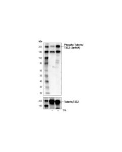 Cell Signaling Phospho-Tuberin/Tsc2 (Ser664) (D3b9z) Rabbit mAb