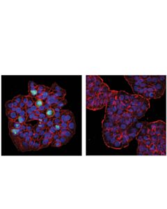 Cell Signaling Phospho-Casc5 (Thr943/Thr1155) (D8d4n) Rabbit mAb