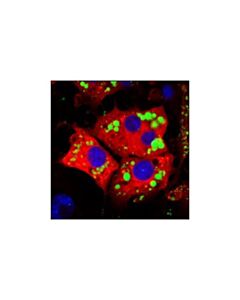 Cell Signaling Hsl Antibody