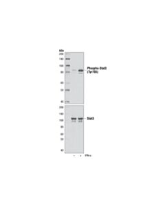 Cell Signaling Phospho-Stat3 (Tyr705) (M9c6) Mouse mAb