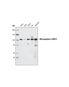 Cell Signaling Microcephalin-1/Brit1 (D38g5) Rabbit mAb