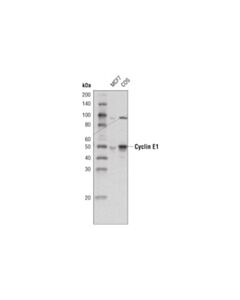 Cell Signaling Cyclin E1 (He12) Mouse mAb