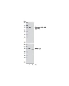 Cell Signaling Phospho-Alk (Tyr1096) Antibody