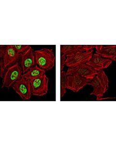 Cell Signaling Phospho-Glucocorticoid Receptor (Ser211) Antibody