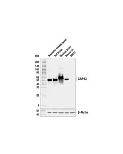 Cell Signaling Gap43 (E6l2w) Mouse mAb