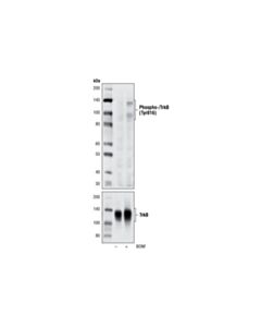 Cell Signaling Phospho-Trka (Tyr785)/Trkb (Tyr816) (C67c8) Rabbit mAb