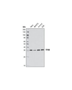 Cell Signaling Tfiib (2f6a3h4) Mouse mAb